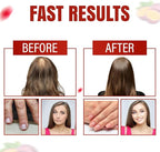Everyday Glow Biotin 6000mcg & Marine Collagen Gummies | Advanced Dietary Supplement for Hair Skin and Nails Vitamins with B-Complex, Zinc, Vitamin C & E | Passion Fruit, Non-GMO, 60ct