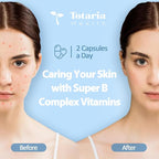 13-in-1 Vitamin B Complex Plus with Vitamin B1, B2, B3 (Niacin), B4, B5, B6, B7 (Biotin), B8 (Inositol), B9 (Folate), B12, C, D3, K2 for Energy, Nerve, Immune, Skin - 120 Caps per Bottle - 2 Bottles