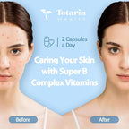 13-in-1 Vitamin B Complex Plus with Vitamin B1, B2, B3 (Niacinamide), B4, B5, B6, B7 (Biotin), B8 (Inositol), B9 (Folate), B12, C, D3, K2 - Energy, Nerve, Immune, Skin Support - 120 Vegan Capsules