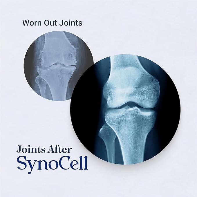 Synocell Glucosamine Chondroitin Complex 4 Pack Back, Neck, and Joint Support Supplement with Boswellia, Quercetin, & MSM - Renew Your Joints from The Inside Out - Move with Freedom and Ease
