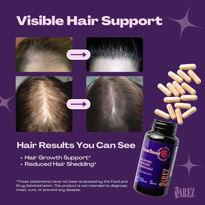 Sarez GlowBoost Collagen Booster — MSM, Bamboo Silica, Astaxanthin, Pomegranate, Biotin & Grape Seed — Supports Collagen Production & Protection, Skin Renewal, Hair & Nail Strength — 30 Day Supply
