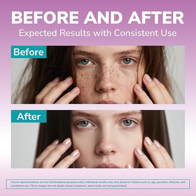 Biotin 10000mcg, Vitamin B7, Hydrolyzed Keratin, Hyaluronic Acid, Collagen, Amino Acids, MSM, Vitamins A, C, D3, B Complex, Hair, Nail, Skin, for Men and Women, 30 Caps