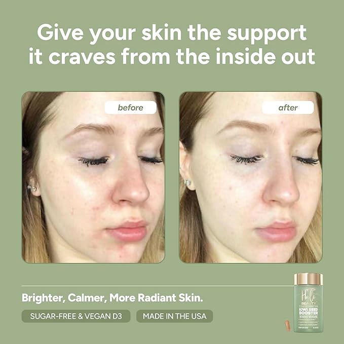 Halo Beauty Kiwi Seed Booster Skin Supplement | Skin Brightening & Anti-Aging Hydration with Kiwi Seed, Vitamin C, D3, MSM & Zinc | Vegan Collagen Support Capsules | Made in USA | 1-Month Supply