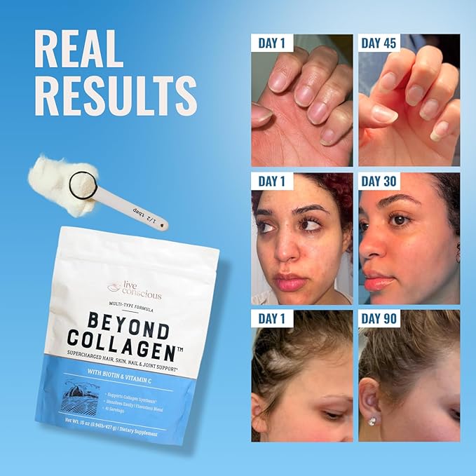 Live Conscious Beyond Collagen Multi Collagen Powder for Women w/Types I, II, III, V & X - Keto Friendly, Hydrolyzed Collagen Peptides Powder Blend w/Biotin & Vitamin C 41 Servings