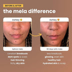 Mela Daily Glow for Healthy Melanin-Rich Skin & Textured Hair – with Silica, Millet, Pumpkin Seed, Probiotics, Hyaluronic Acid & Vitamin D3 – Vegan, Biotin-Free, Gluten & Soy-Free – 60 Count
