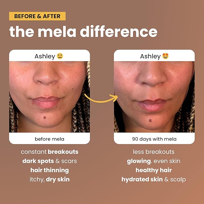 Mela Daily Glow for Healthy Melanin-Rich Skin & Textured Hair – with Silica, Millet, Pumpkin Seed, Probiotics, Hyaluronic Acid & Vitamin D3 – Vegan, Biotin-Free, Gluten & Soy-Free – 60 Count