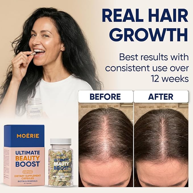 Moerie Ultimate Hair Growth Supplements for Women & Men - Hair, Skin, Nails Vitamins with Biotin & Minerals - for Thicker, Fuller Hair & Hair Loss Treatment - 360 Capsules