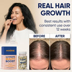Moerie Ultimate Hair Growth Supplements for Women & Men - Hair, Skin, Nails Vitamins with Biotin & Minerals - for Thicker, Fuller Hair & Hair Loss Treatment - 360 Capsules