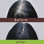 Nzuri Elixir Hair Skin and Nails Vitamins for Women and Men with Biotin, Folate, and Vitamin D for Daily Growth Supplement to Reducing Dryness, Thinning, and Loss, 32 oz.