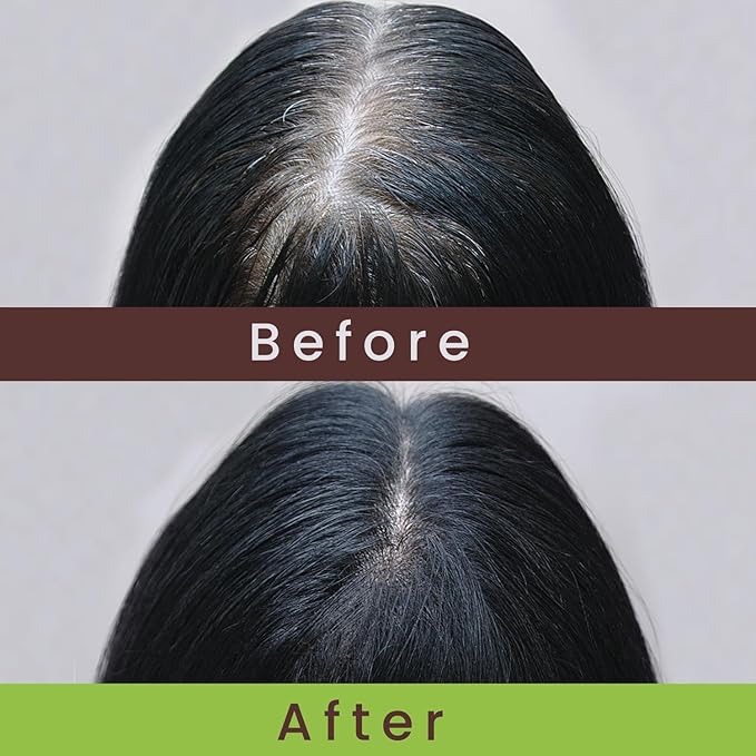 Nzuri Elixir Hair Skin and Nails Vitamins for Women and Men with Biotin, Folate, and Vitamin D for Daily Growth Supplement to Reducing Dryness, Thinning, and Loss, 32 oz.