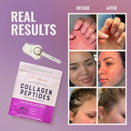 Live Conscious Collagen Peptides Powder - Naturally-Sourced Hydrolyzed Collagen Powder - Hair, Skin, Nail, and Joint Support - Type I & III Grass-Fed Collagen Supplements for Women and Men - 16oz