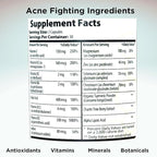 Clear Skin Acne Vitamins Capsules | Complexion Supplements with Pantothenic Acid B5, Zinc Picolinate, Vitex Chasteberry | 60 Count