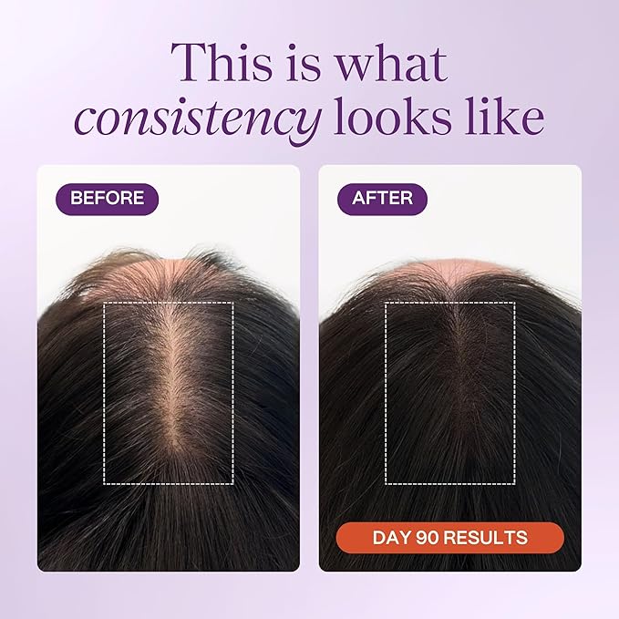 KeraLush Hair Vitamins for Women | Supports Healthy Thick Hair & Volume, Strong Roots, Scalp Care | Biotin, Patented Keratin, Ashwagandha, Vitamin B5, Protects from Pollutants | 30 Servings