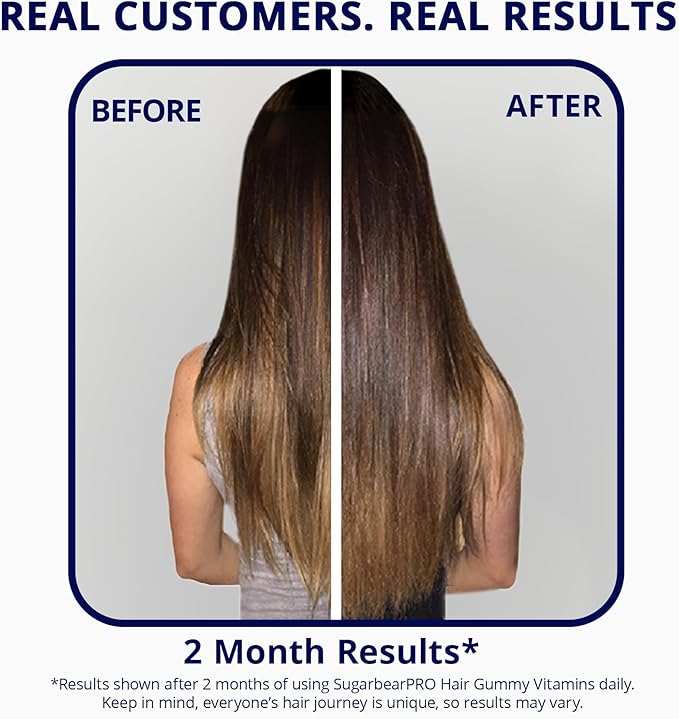 SugarBearPro Hair Vitamin Gummy 1 Month Supply, Extra Strength Biotin 6000mcg for Hair Growth, Vegan Vitamin B12, MSM, Inositol, Omega 3, Elderberry, Certified Kosher, Halal, Cruelty-Free