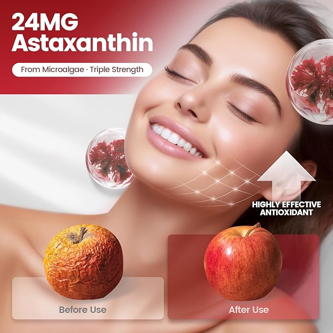 VivoNu Astaxanthin 24mg – Powerful Antioxidant Support for Skin, Eyes & Immune System – 10-in-1 Formula with Lycopene, Grape Seed, Vitamin E & Zinc – Triple Strength, 720 Softgels, 3 Bag