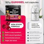 VitaUp Beet Root Gummies – Beetroot Supplement with CoQ10, Grape Seed, Vitamin C, B12 & B3 – Nitric Oxide Gummies for Circulation Support – Beet Supplement for Energy & Immune Support – 120 Beet Chews