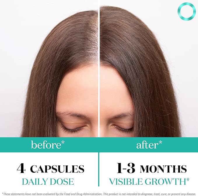 Women's Balance Hair Growth Supplements, Ages 45 and Up, Customer Proven for Visibly Thicker Hair and Scalp Coverage, Soy-Free, Made with 26 Ingredients including Beta Carotenes - 3 Month Supply