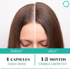 Women's Balance Hair Growth Supplements, Ages 45 and Up, Customer Proven for Visibly Thicker Hair and Scalp Coverage, Soy-Free, Made with 26 Ingredients including Beta Carotenes - 3 Month Supply
