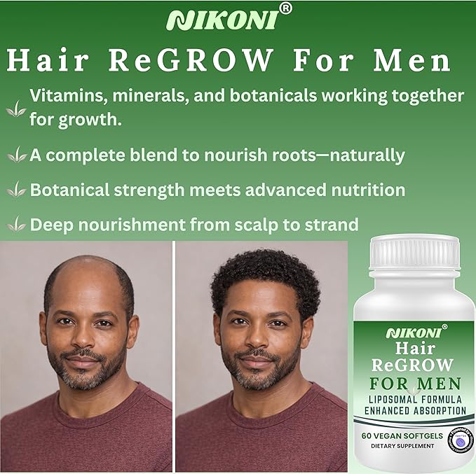 Nikoni Hair ReGROW for Men – Liposomal Hair Support Liposomal Formula with Biotin, Keratin, Saw Palmetto & Essential Nutrients-60 Vegan Softgels