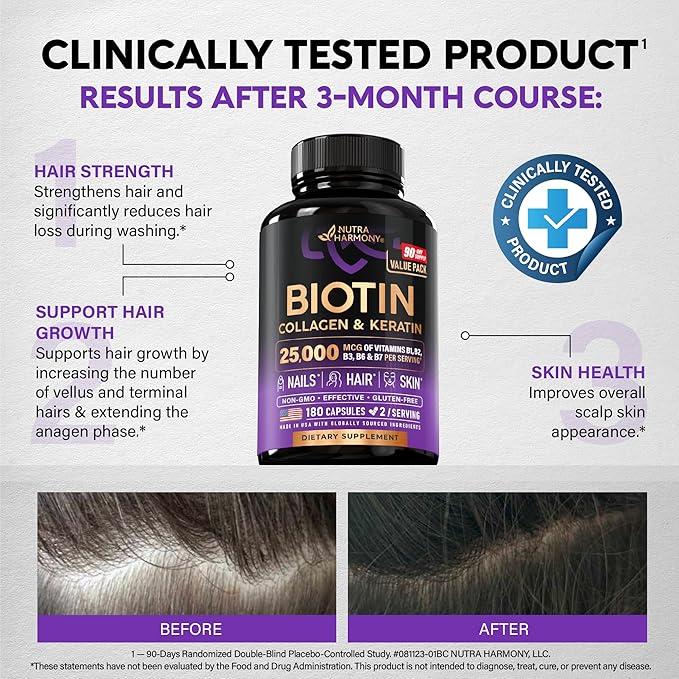 Biotin | Collagen | Hyaluronic Acid | Keratin - Clinically Tested Supplement - Hair Growth Support, Skin & Nails - 25000 mcg Vitamins B2, B3, B6 & B7 + B1 - Made in USA - Women & Men | 180 Capsules