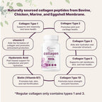 Micro Ingredients 8-in-1 Multi Collagen Pills & Women’s Probiotics 100 Billion CFU Veggie Capsules | 2 Pack | Hydrolyzed Peptides + Hyaluronic Acid & Vitamin C | 40 Strains + Cranberry & D-Mannose