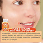 L-Lysine Gummies 1000mg - L-Lysine Supplements for Kids and Adults - Lip and Cold Sore* Support for Women - Chewable Lysine Gummies with Vitamin B12 - Vegan, Non GMO, Gluten-Free, 120 Counts