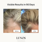 Lunos Grow Hair Growth Supplements - 17 Ingredient Vitamin with Biotin, Saw Palmetto, & Marine Collagen - Hair Growth Products for Women & Men - 1 Month Supply
