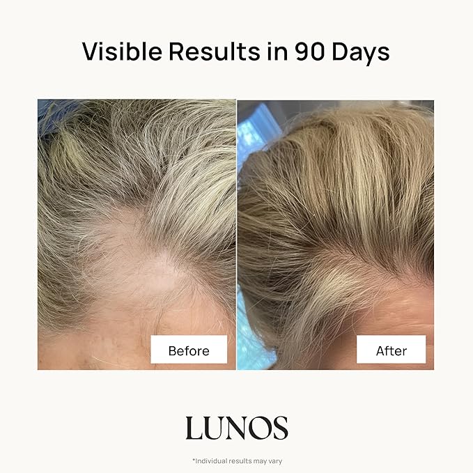 Lunos Grow Hair Growth Supplements - 17 Ingredient Vitamin with Biotin, Saw Palmetto, & Marine Collagen - Hair Growth Products for Women & Men - 1 Month Supply