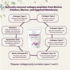 Micro Ingredients Multi Collagen Peptides Powder, 2lb – Hydrolyzed Type I,II,III,V,X with Biotin, Hyaluronic Acid, Vitamin C – Unflavored Collagen for Women & Men, Easy Dissolve, 82 Servings