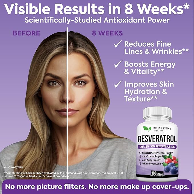 Extra Strength Resveratrol 1568mg - 180 Capsules - 3 Months Supply | Antioxidant Supplement | Natural Trans-Resveratrol Pills | for Anti-Aging, Heart Health, Immune System & Brain Function