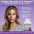 Extra Strength Resveratrol 1568mg - 180 Capsules - 3 Months Supply | Antioxidant Supplement | Natural Trans-Resveratrol Pills | for Anti-Aging, Heart Health, Immune System & Brain Function