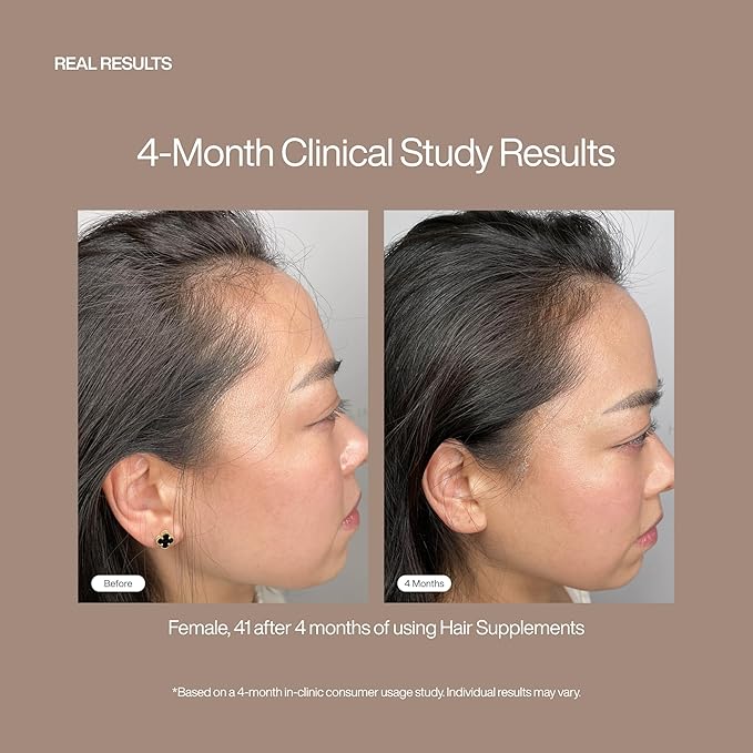 Harklinikken Hair Supplement - 60 Capsules, Pack of 6 - Visibly Thicker, Denser Hair in 3+ Months - Suitable for Men & Women