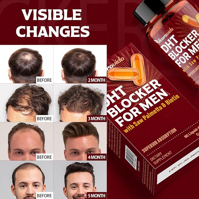 DHT Blocker for Men | Hair Growth Vitamins Supplement with Saw Palmetto & Biotin - Hair Regrowth - Natural Hair Loss Supplements Liquid-Filled - Proprietary Herbal Blends (90 Capsules)