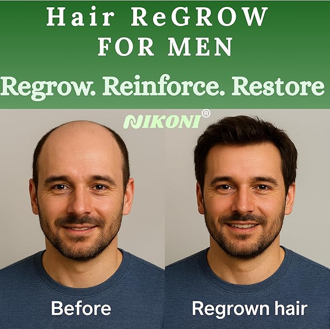 Nikoni Hair ReGROW for Men – Liposomal Hair Support Liposomal Formula with Biotin, Keratin, Saw Palmetto & Essential Nutrients-60 Vegan Softgels