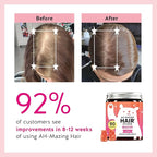 Biotin Gummies for Hair, Skin & Nails. 5,000 mcg High Potency Vegan Vitamins for Faster Hair Growth, Stronger Nails & Healthy Skin. with Vitamins C & E, 60 Gummies