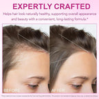 Hair Skin Nail Multivitamin & Biotin, 5000 mcg Biotin of Per Serving with Vitamin A/C/E/B Vitamins/Collagen/Keratin/Argan Oil for Hair/Nail Growth, Radiant Skin Support - for Women & Men|400 Pcs