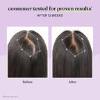 Lemme Grow Hair Growth Supplement for Women, Clinically Proven Keratin Complex for Visibly Thicker Hair and Scalp Coverage, Reduced Shedding, Nourish Thinning Hair - 1 Month Supply