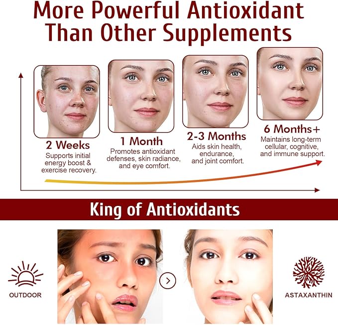 NenMaoKeNu Astaxanthin 12mg, Premium Astaxanthin Antioxidant Supplements with Antioxidant Activity, Supports Eye, Immune, Skin Health, Internal Circulation-120 Softgels