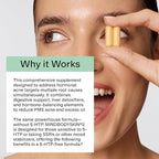 CLEARSTEM - MINDBODYSKIN Hormonal Acne Supplement (No 5-HTP) - Natural DIM Supplement - Skin Care Vitamins - Hormone Balance, Antioxidants - Gluten Free, Cruelty Free - 30 Servings, 90 Capsules