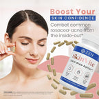 Zen Nutrients SkinVite Natural Skin Supplement for Women, Men & Teens - Hormonal Breakouts & Clear Skin Support Supplement - Detoxifying Vitamin for Acne and Digestion Support