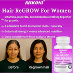 Nikoni Hair ReGROW Women’s Liposomal Formula – Biotin, Keratin, Saw Palmetto & Botanical Essentials-60 Vegan Softgels