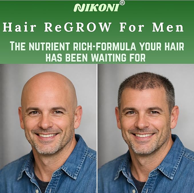Nikoni Hair ReGROW for Men – Liposomal Hair Support Liposomal Formula with Biotin, Keratin, Saw Palmetto & Essential Nutrients-60 Vegan Softgels