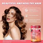 Hair Skin and Nails Vitamins – Biotin, Hyaluronic Acid, Calcium AKG, Vitamin C & Vitamin D3 K2 – Support Healthy Hair Growth, Strong Nails & Radiant Skin - 120 Capsules (1 Pack)
