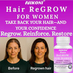Nikoni Hair ReGROW Women’s Liposomal Formula – Biotin, Keratin, Saw Palmetto & Botanical Essentials-60 Vegan Softgels